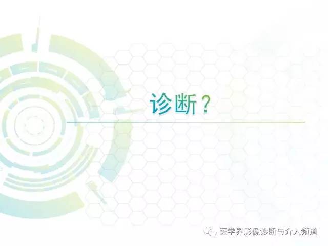 【病例】髓内星形细胞瘤1例MR影像表现