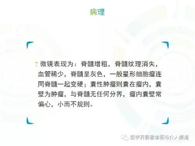 【病例】髓内星形细胞瘤1例MR影像表现