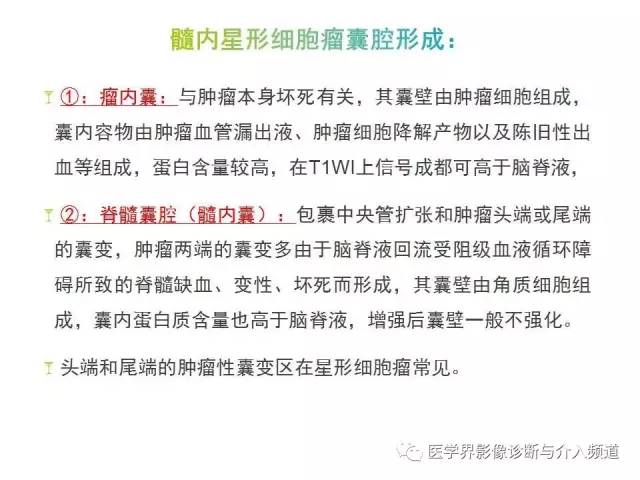 【病例】髓内星形细胞瘤1例MR影像表现