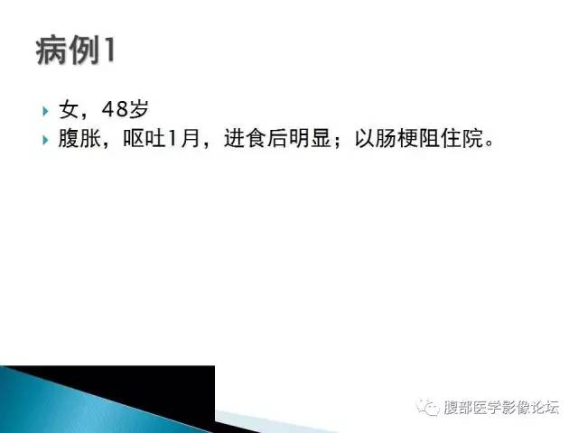 【病例】小肠占位3例X线CT影像表现