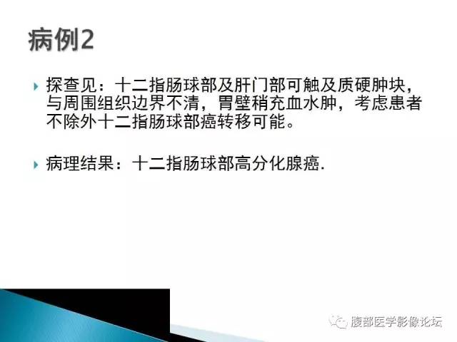 【病例】小肠占位3例X线CT影像表现