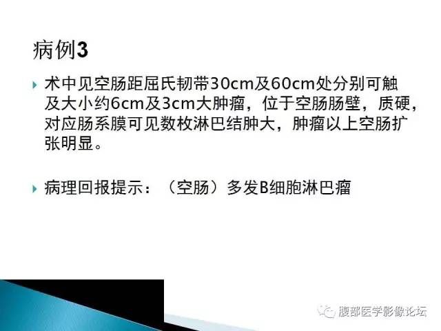 【病例】小肠占位3例X线CT影像表现