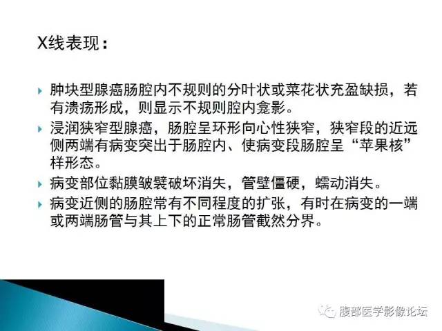 【病例】小肠占位3例X线CT影像表现