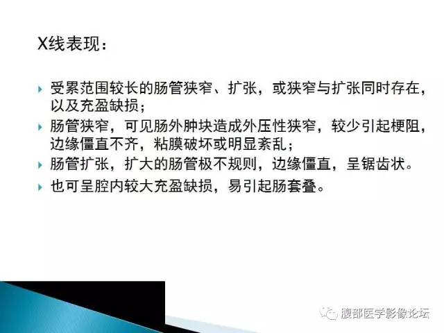 【病例】小肠占位3例X线CT影像表现