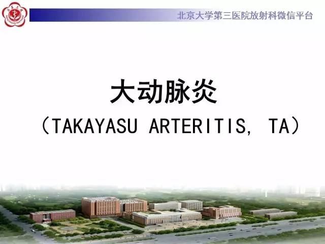 【病例】双侧锁骨下动脉动脉炎1例MR
