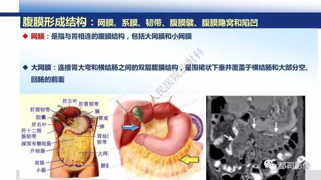 【PPT】腹膜解剖及其炎性病变影像诊断
