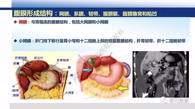 【PPT】腹膜解剖及其炎性病变影像诊断