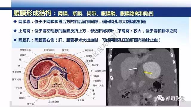 【PPT】腹膜解剖及其炎性病变影像诊断