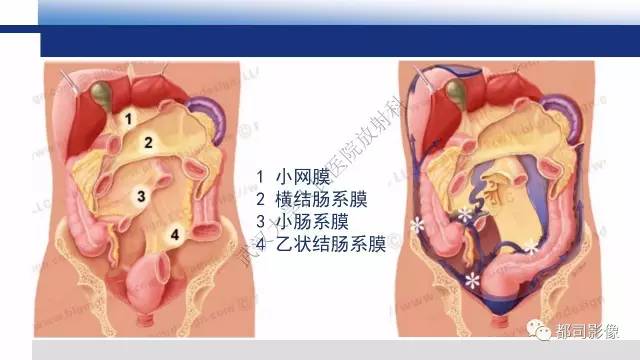【PPT】腹膜解剖及其炎性病变影像诊断