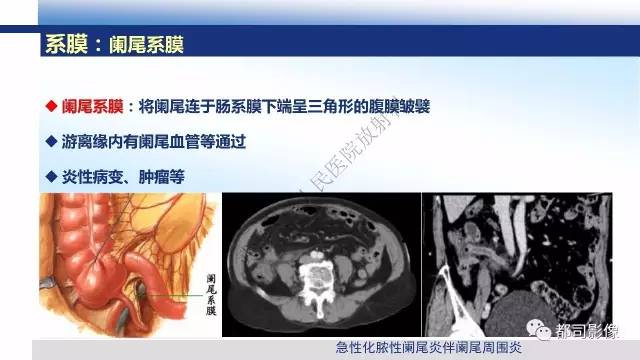 【PPT】腹膜解剖及其炎性病变影像诊断