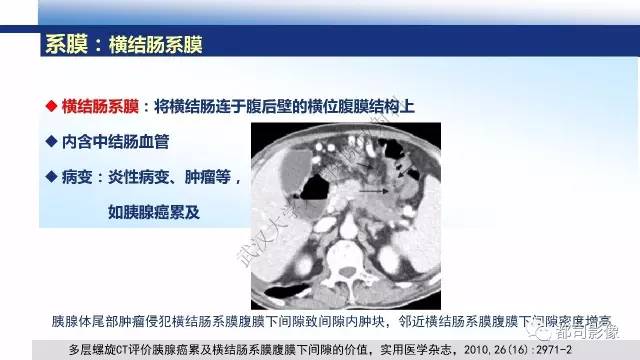 【PPT】腹膜解剖及其炎性病变影像诊断