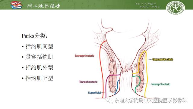 【PPT】克罗恩病肛周病变的MR表现