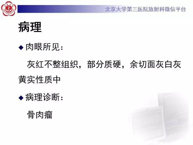 【病例】颈椎骨肉瘤1例CT及MR影像表现
