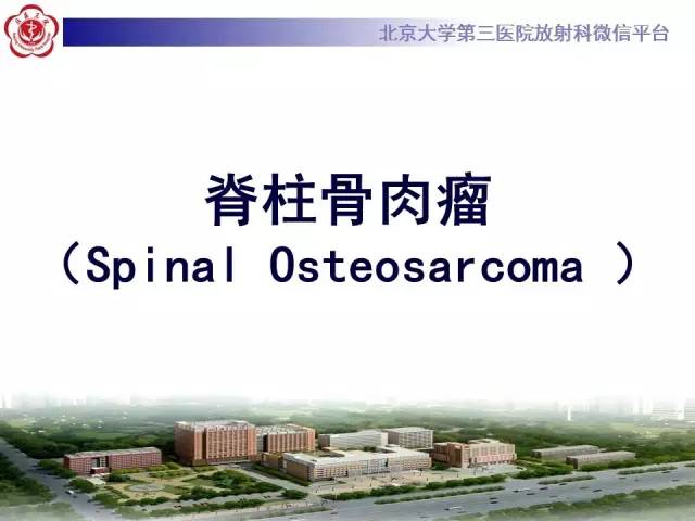 【病例】颈椎骨肉瘤1例CT及MR影像表现