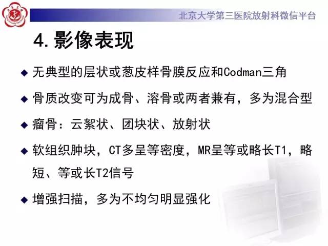 【病例】颈椎骨肉瘤1例CT及MR影像表现