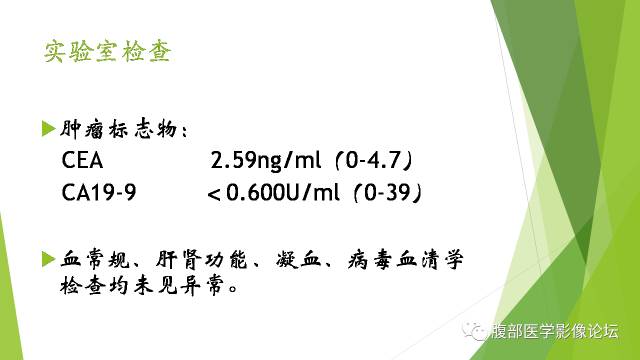 【病例】胰腺实性假乳头状瘤1例CT