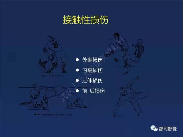 【PPT】前交叉韧带损伤及重建术后MR评价