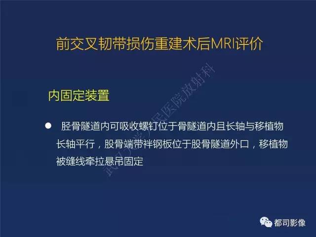 【PPT】前交叉韧带损伤及重建术后MR评价