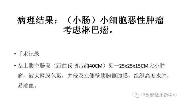 【病例】小肠淋巴瘤1例X线CT