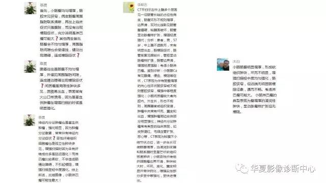 【病例】小肠淋巴瘤1例X线CT