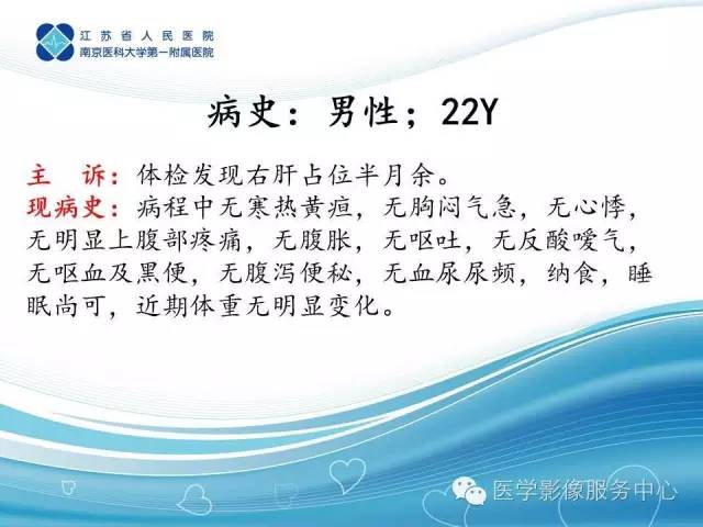 【病例】肝脏局灶性结节性增生1例CT及MR