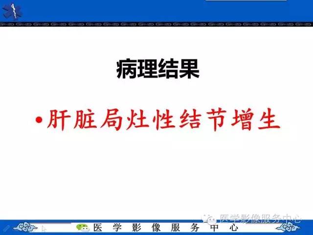 【病例】肝脏局灶性结节性增生1例CT及MR