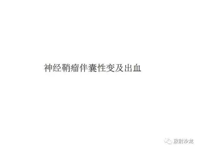 【PPT】垂体瘤的MR诊断与鉴别诊断
