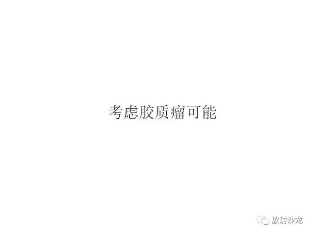 【PPT】垂体瘤的MR诊断与鉴别诊断
