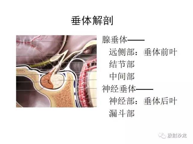 【PPT】垂体瘤的MR诊断与鉴别诊断
