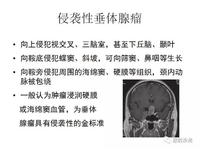 【PPT】垂体瘤的MR诊断与鉴别诊断