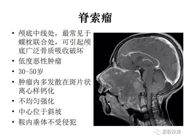 【PPT】垂体瘤的MR诊断与鉴别诊断