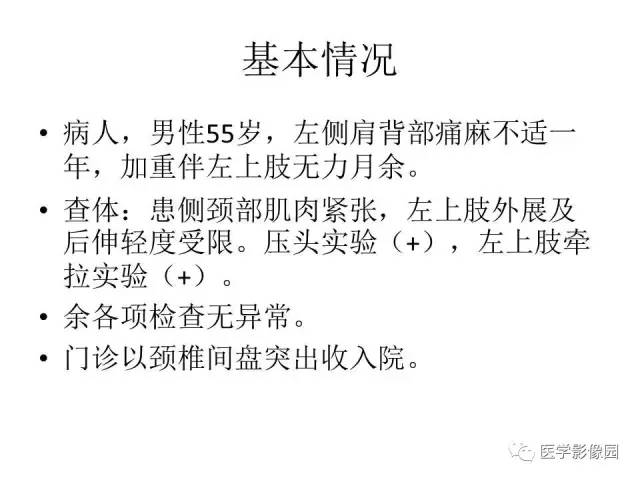 【病例】跨椎管占位——神经鞘瘤1例CT及MR