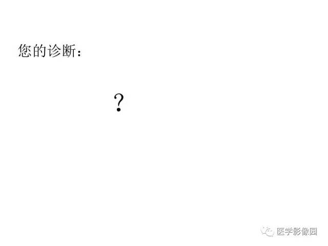 【病例】跨椎管占位——神经鞘瘤1例CT及MR