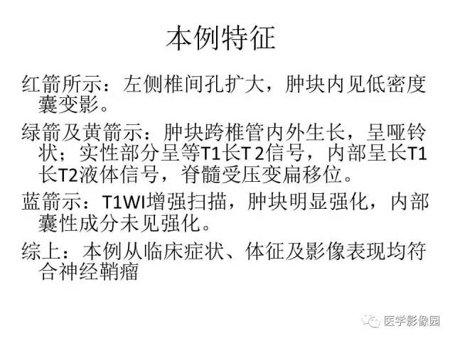 【病例】跨椎管占位——神经鞘瘤1例CT及MR