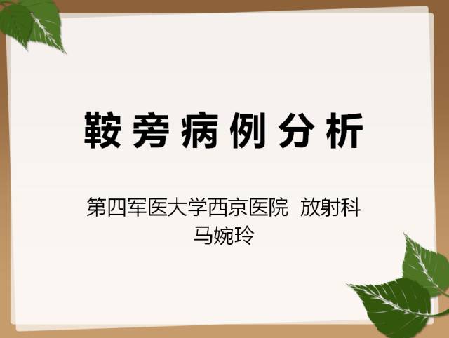 【PPT】鞍旁病例分析