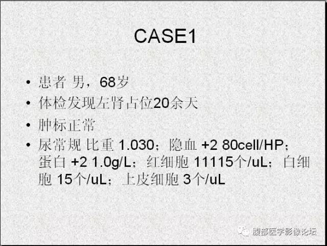【病例】多房囊性肾癌1例CT
