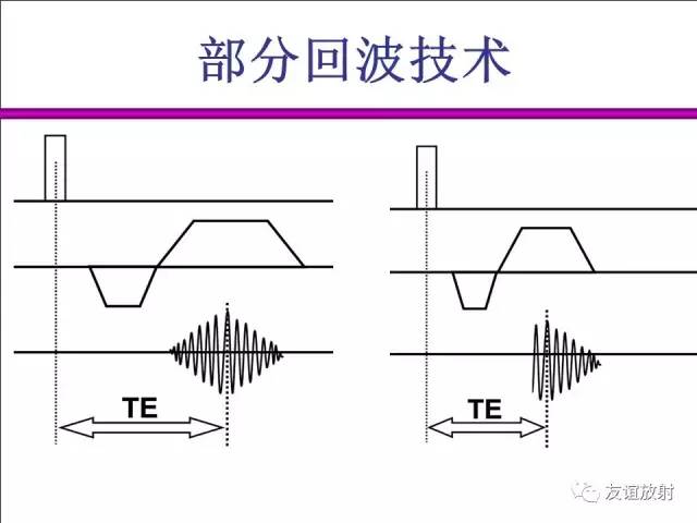 【PPT】基于K空间的MR快速成像技术