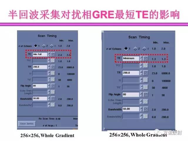 【PPT】基于K空间的MR快速成像技术