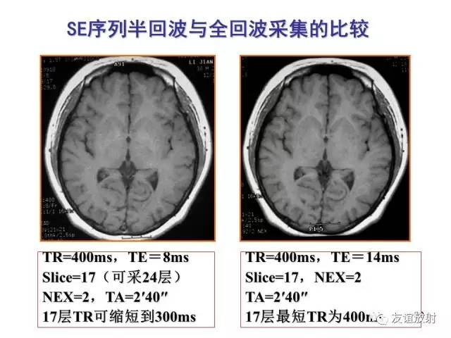 【PPT】基于K空间的MR快速成像技术
