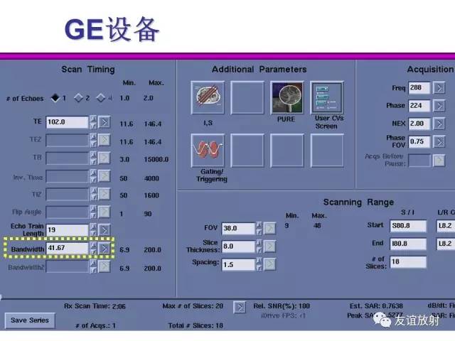 【PPT】基于K空间的MR快速成像技术