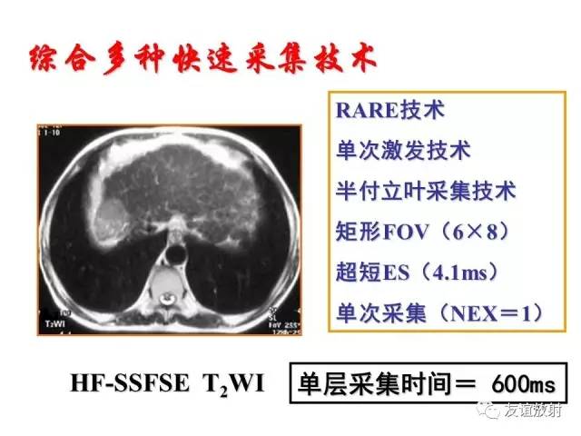 【PPT】基于K空间的MR快速成像技术