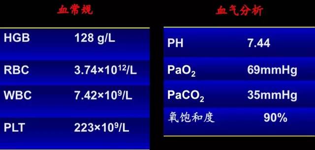 【病例】职业性过敏性肺炎1例 【病例】职业性过敏性肺炎1例