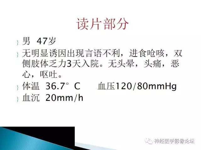 【病例】脑实质结核1例MR