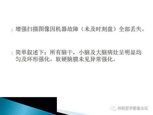 【病例】脑实质结核1例MR