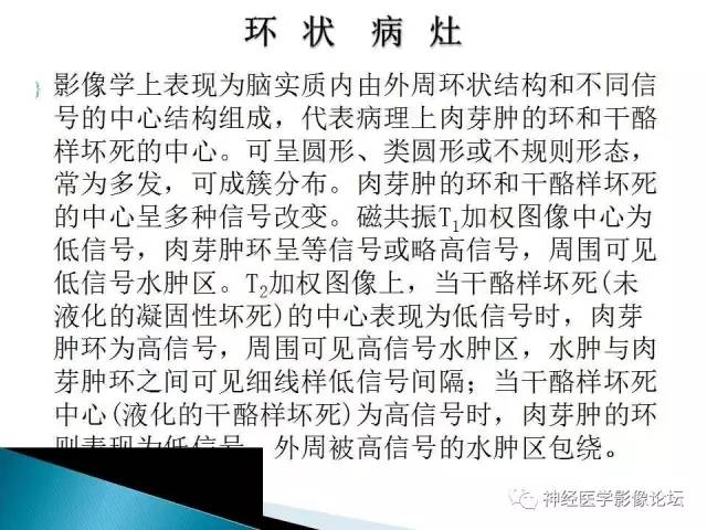 【病例】脑实质结核1例MR
