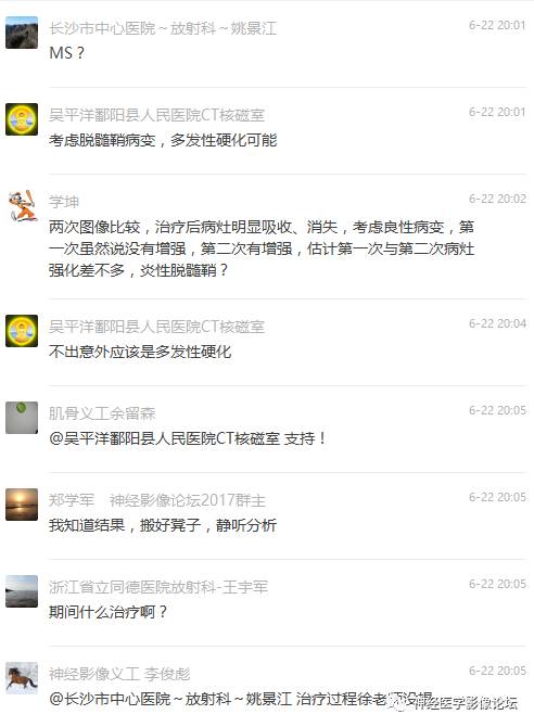 【病例】脑实质结核1例MR