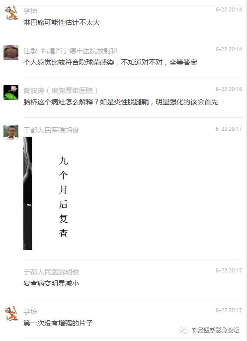 【病例】脑实质结核1例MR