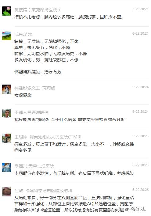 【病例】脑实质结核1例MR