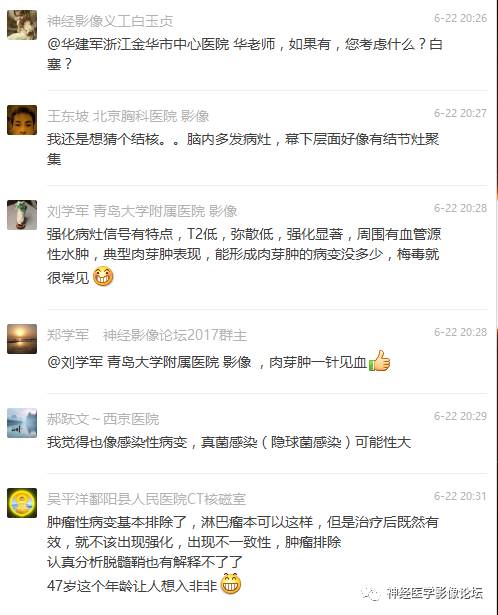 【病例】脑实质结核1例MR