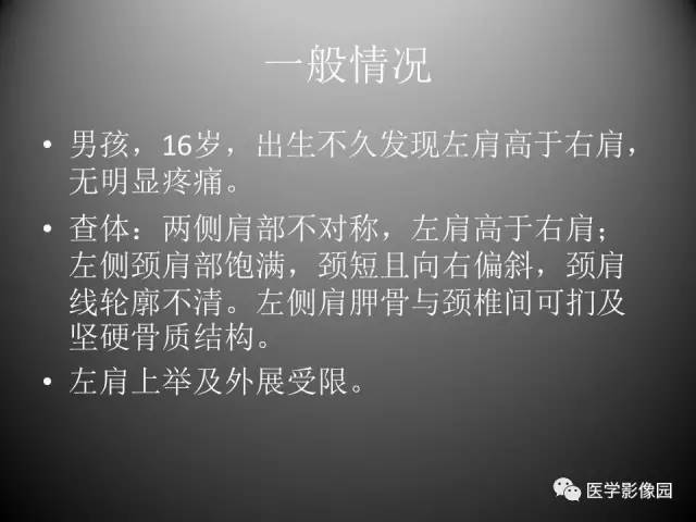【病例】先天性肩胛骨高位症1例CT影像表现